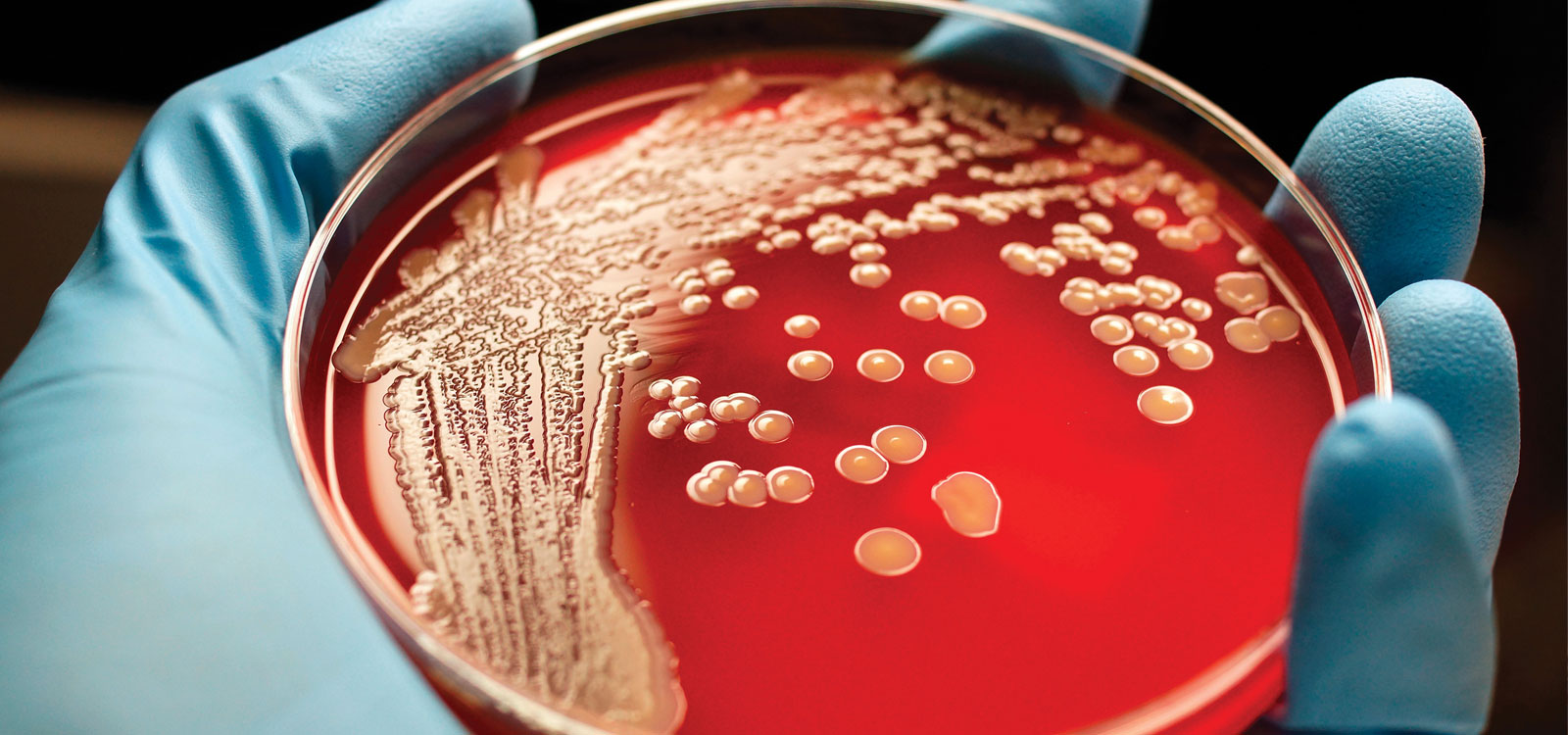 Types Of Animal Tissue Culture