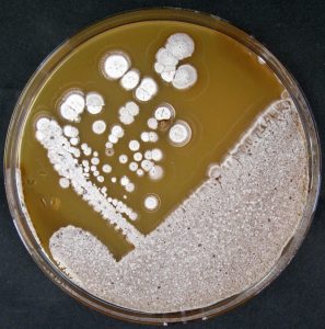 Production of Streptomycin and Product Recovery