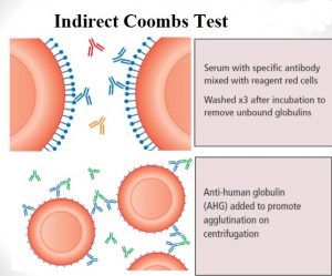 Coomb's Test