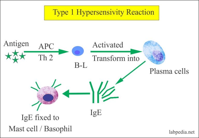 Type 1 hypersensitivity reaction 2