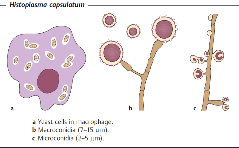 Histoplasma capsulatum Histoplasmosis