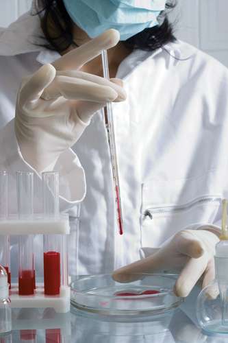 Blood analysis blood sample properties diagnosis disease