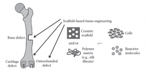 The concept of skeletal tissue regeneration via scaffold based tissue