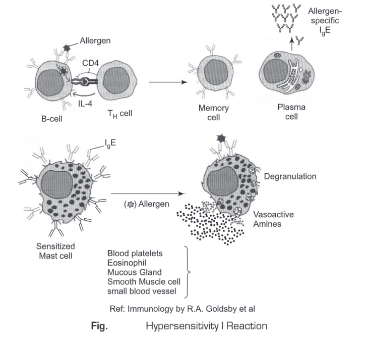 Hypersensitive Reactions and Its Types