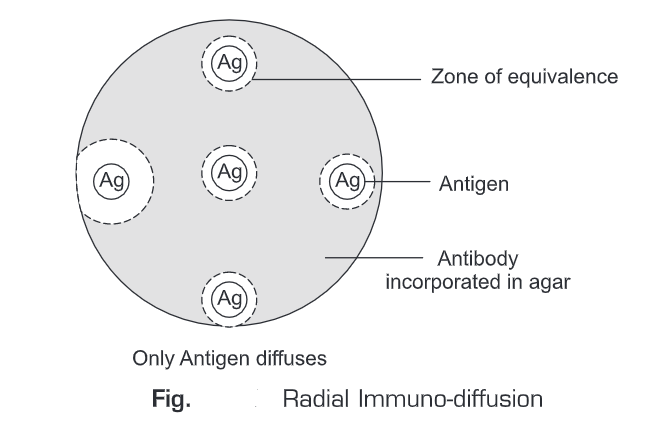 Antigen Antibody Reactions