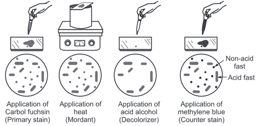 Acid fast staining