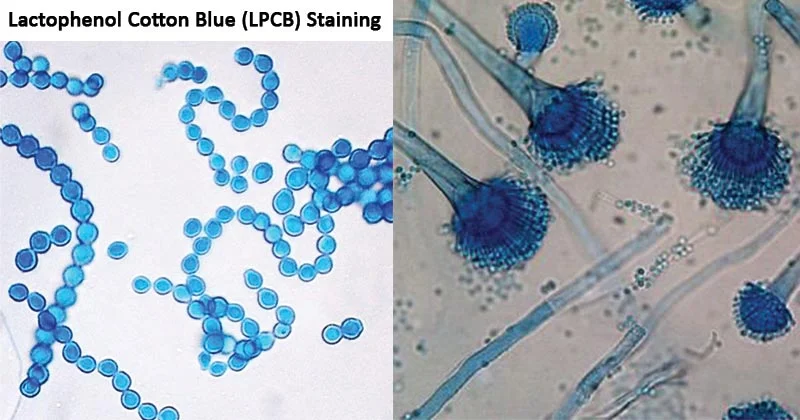 Lactophenol Cotton Blue (LPCB) Staining